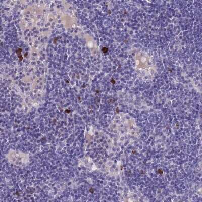 Immunohistochemistry-Paraffin: ACAP4 Antibody [NBP2-48550]