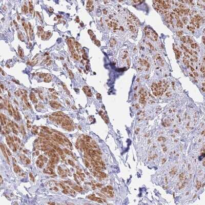 Immunohistochemistry-Paraffin: ACAP4 Antibody [NBP2-48551]