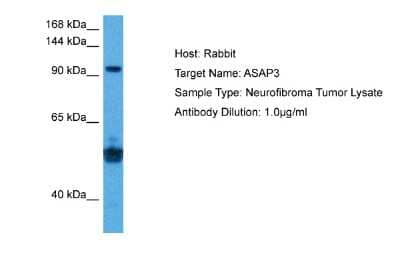 Western Blot: ACAP4 Antibody [NBP2-86943]