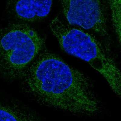 Immunocytochemistry/ Immunofluorescence: SOAT1 Antibody [NBP2-32052]