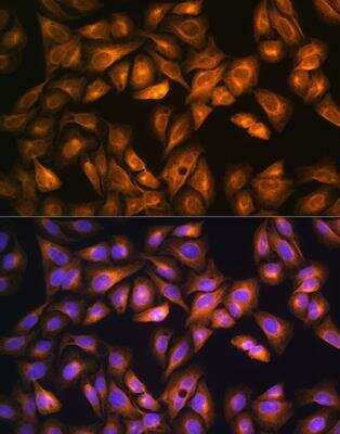 Immunocytochemistry/ Immunofluorescence: SOAT1 Antibody - BSA Free [NBP2-92471]