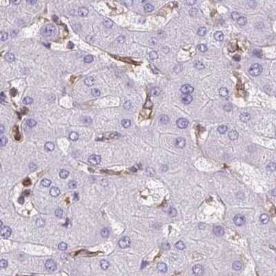Immunohistochemistry: SOAT1 Antibody [NBP2-32052]