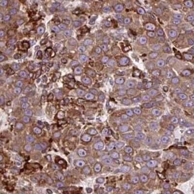 Immunohistochemistry: SOAT1 Antibody [NBP2-32052]