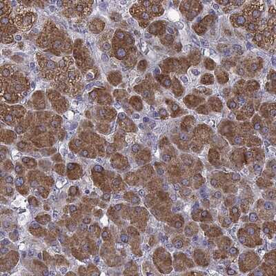 Immunohistochemistry-Paraffin: SOAT1 Antibody [NBP2-32052]