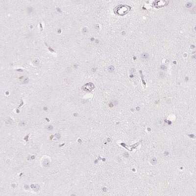 Immunohistochemistry-Paraffin: SOAT1 Antibody [NBP2-32052]