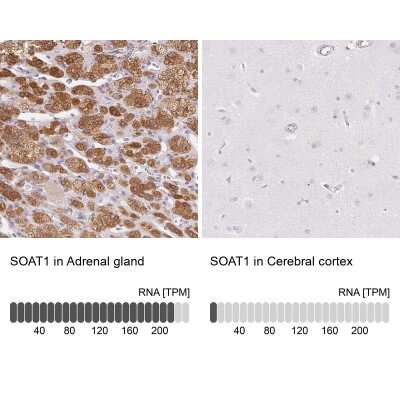 Immunohistochemistry-Paraffin: SOAT1 Antibody [NBP2-32052]