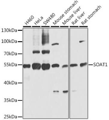 Western Blot: SOAT1 AntibodyBSA Free [NBP2-92471]