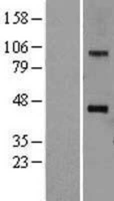 Western Blot: SOAT1 Overexpression Lysate [NBP2-10868]