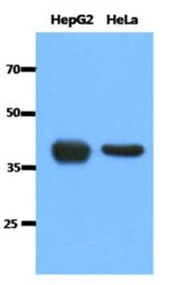 Western Blot: ACAT1 Antibody (2C5)BSA Free [NBP2-22565]