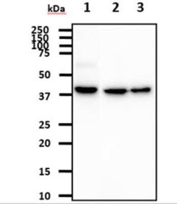 Western Blot: ACAT1 Antibody (2C5)BSA Free [NBP2-22565]