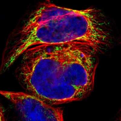 Immunocytochemistry/ Immunofluorescence: ACAT1 Antibody [NBP1-89285]
