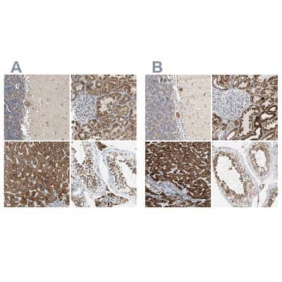 Immunohistochemistry-Paraffin: ACAT1 Antibody [NBP1-89284]