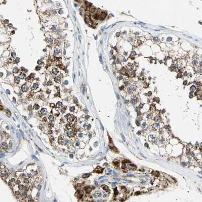 Immunohistochemistry-Paraffin: ACAT1 Antibody [NBP1-89284]