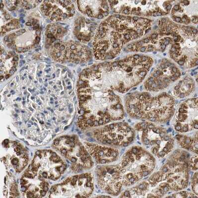 Immunohistochemistry-Paraffin: ACAT1 Antibody [NBP1-89284]