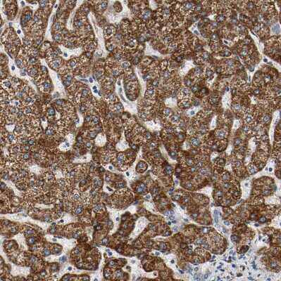 Immunohistochemistry-Paraffin: ACAT1 Antibody [NBP1-89284]
