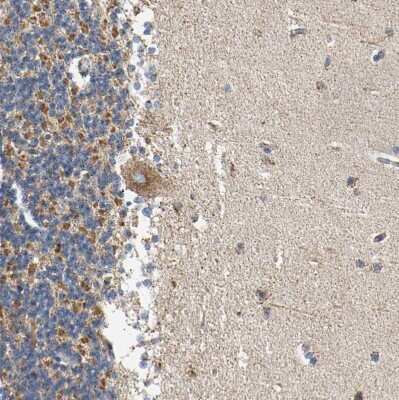 Immunohistochemistry-Paraffin: ACAT1 Antibody [NBP1-89284]