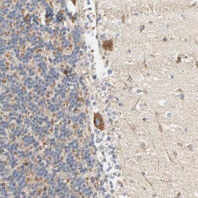 Immunohistochemistry-Paraffin: ACAT1 Antibody [NBP1-89285]
