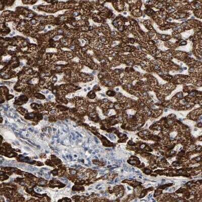 Immunohistochemistry-Paraffin: ACAT1 Antibody [NBP1-89285]