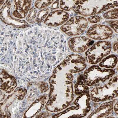 Immunohistochemistry-Paraffin: ACAT1 Antibody [NBP1-89285]