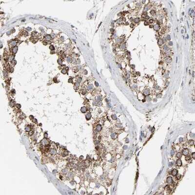 Immunohistochemistry-Paraffin: ACAT1 Antibody [NBP1-89285]