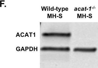 Knockout Validated: ACAT1 Antibody [NBP1-89285]