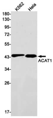 Western Blot: ACAT1 Antibody (S02-5G8) [NBP3-19555]