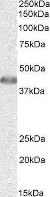 Western Blot: ACAT1 Antibody [NBP1-51994]