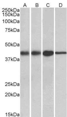 Western Blot: ACAT1 Antibody [NBP1-51994]