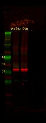 Western Blot: ACAT1 Antibody [NBP1-89284]