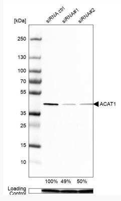 Western Blot: ACAT1 Antibody [NBP1-89284]