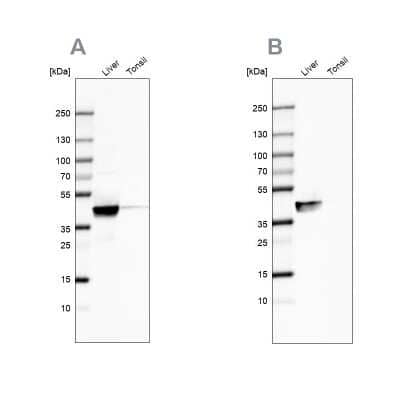 Western Blot: ACAT1 Antibody [NBP1-89284]