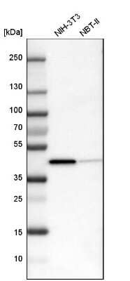 Western Blot: ACAT1 Antibody [NBP1-89285]