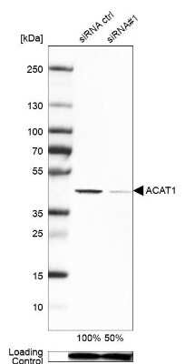 Western Blot: ACAT1 Antibody [NBP1-89285]