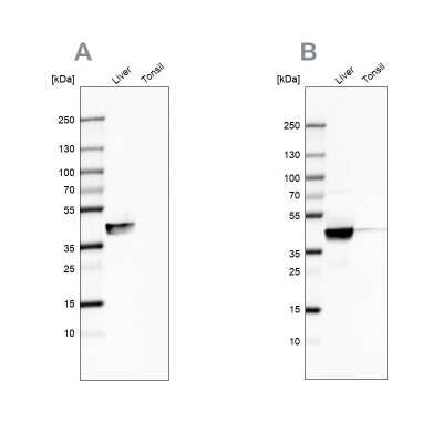 Western Blot: ACAT1 Antibody [NBP1-89285]