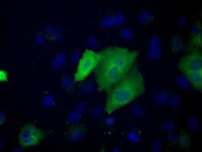 Immunocytochemistry/ Immunofluorescence: ACAT2 Antibody (OTI3E2) [NBP2-02588]