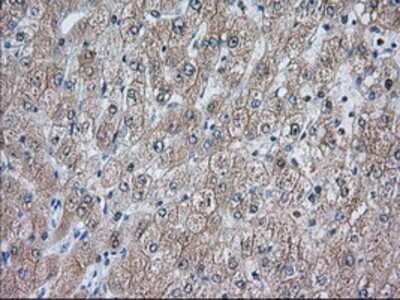 Immunohistochemistry-Paraffin: ACAT2 Antibody (OTI3E2) [NBP2-02588]