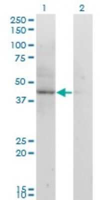 Western Blot: ACAT2 Antibody (4A5) [H00000039-M01]