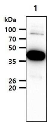 Western Blot: ACAT2 Antibody (55D5)BSA Free [NBP2-42614]