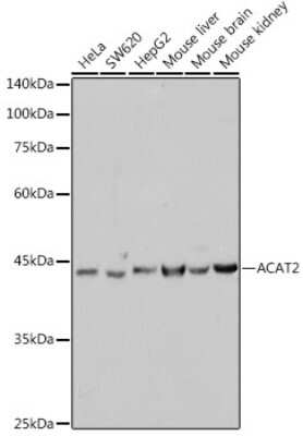Western Blot: ACAT2 Antibody (6Z5L1) [NBP3-15476]