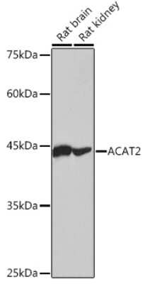 Western Blot: ACAT2 Antibody (6Z5L1) [NBP3-15476]