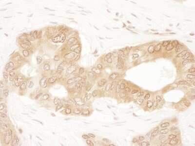 Immunohistochemistry-Paraffin: ACAT2 Antibody [NBP2-32198]