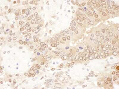 Immunohistochemistry-Paraffin: ACAT2 Antibody [NBP2-32198]