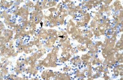 Immunohistochemistry-Paraffin: ACAT2 Antibody [NBP1-54616]
