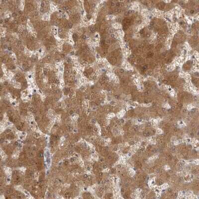 Immunohistochemistry-Paraffin: ACAT2 Antibody [NBP1-85967]
