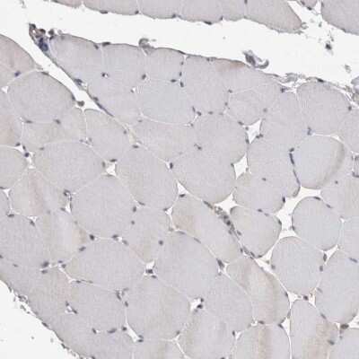 Immunohistochemistry-Paraffin: ACAT2 Antibody [NBP1-85967]