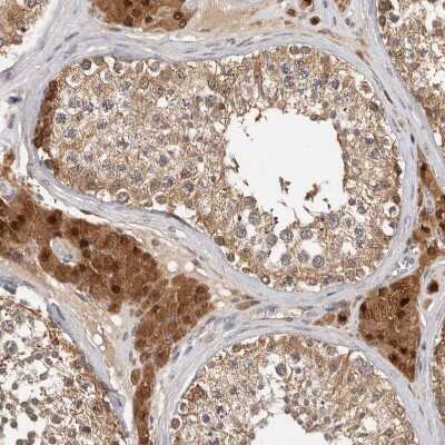 Immunohistochemistry-Paraffin: ACAT2 Antibody [NBP1-85967]