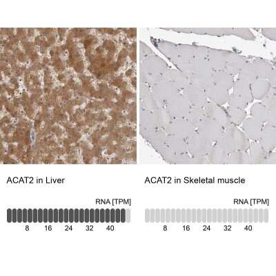 Immunohistochemistry-Paraffin: ACAT2 Antibody [NBP1-85967]