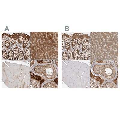 Immunohistochemistry-Paraffin: ACAT2 Antibody [NBP1-89525]