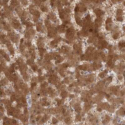 Immunohistochemistry-Paraffin: ACAT2 Antibody [NBP1-89525]