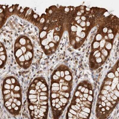 Immunohistochemistry-Paraffin: ACAT2 Antibody [NBP1-89525]